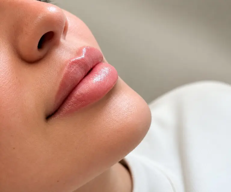 Hyaluronic Acid Filler