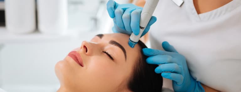 Microneedling
